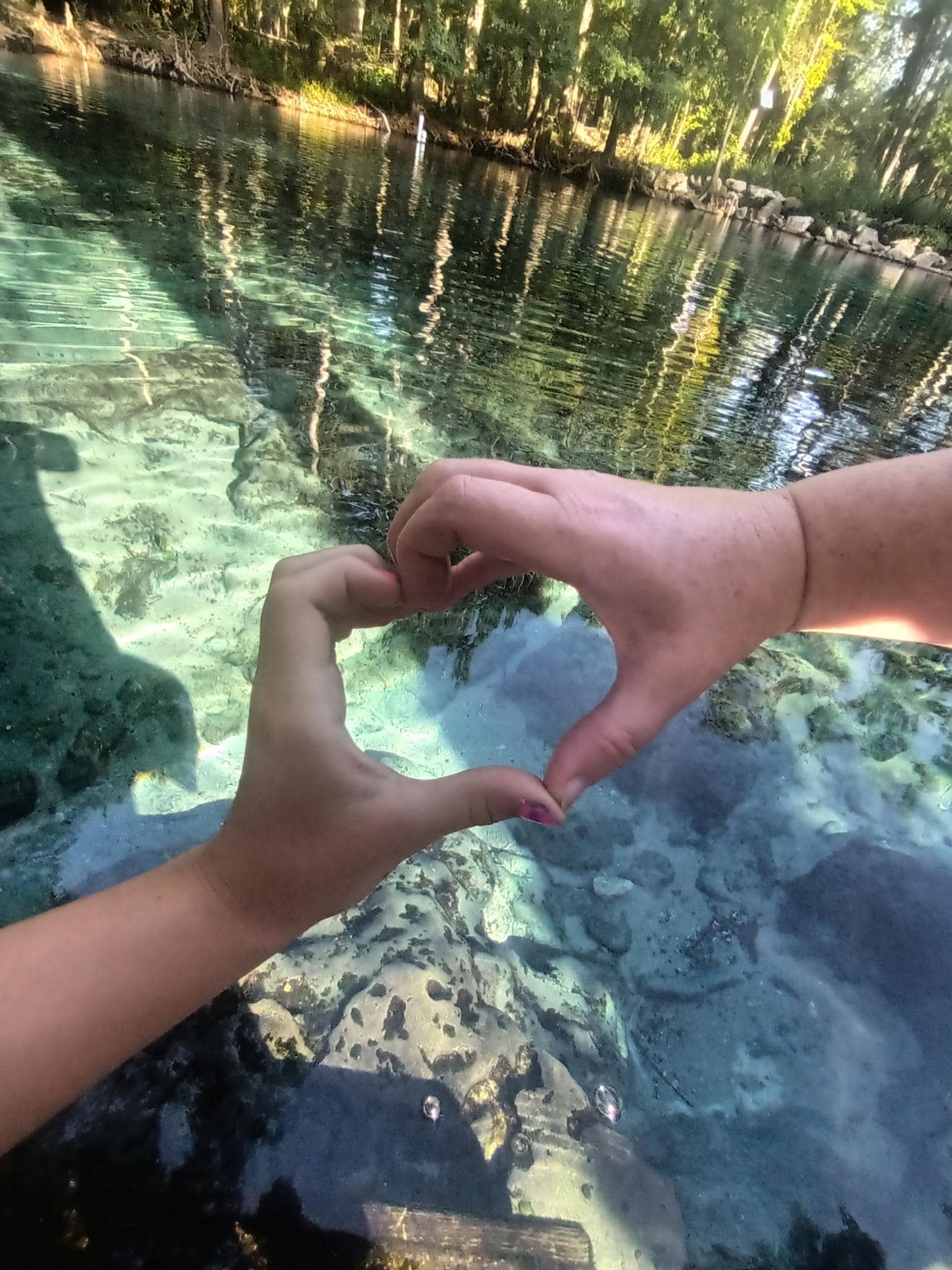 Loved the close springs.