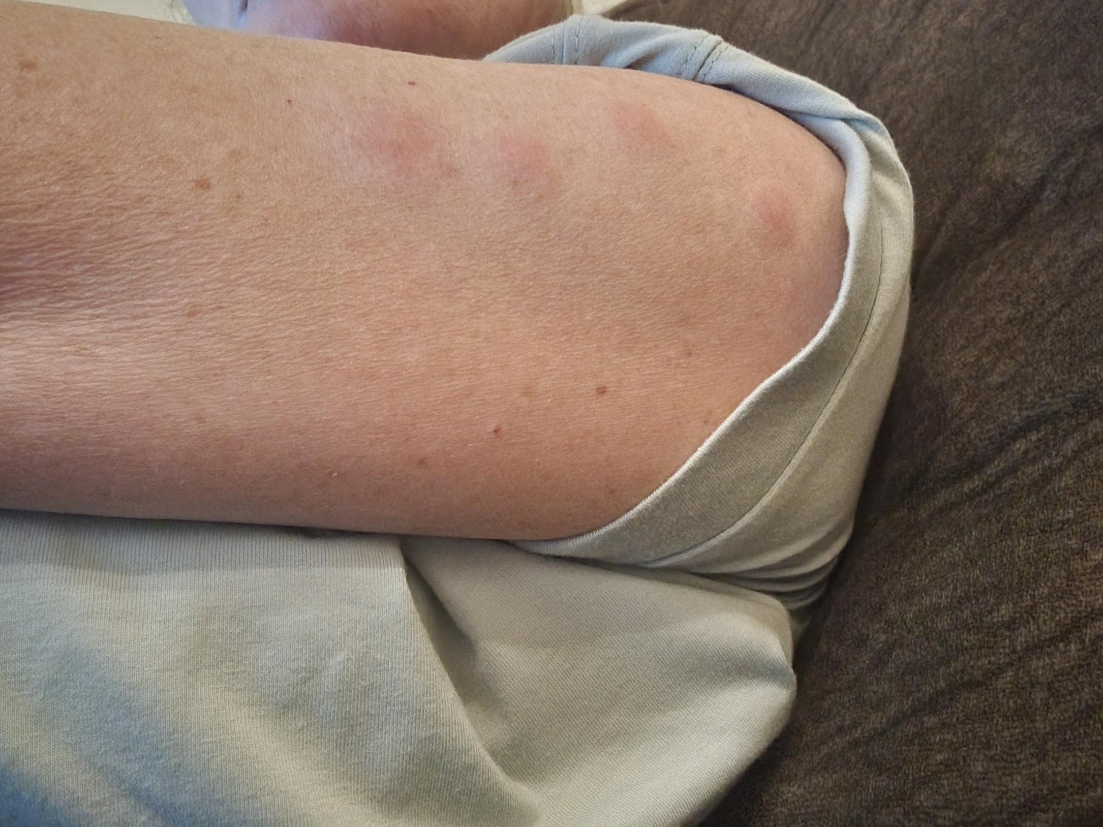 Just a few of my bites. 