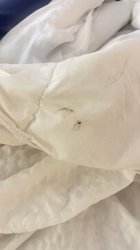 Uncleanliness
The bed linen