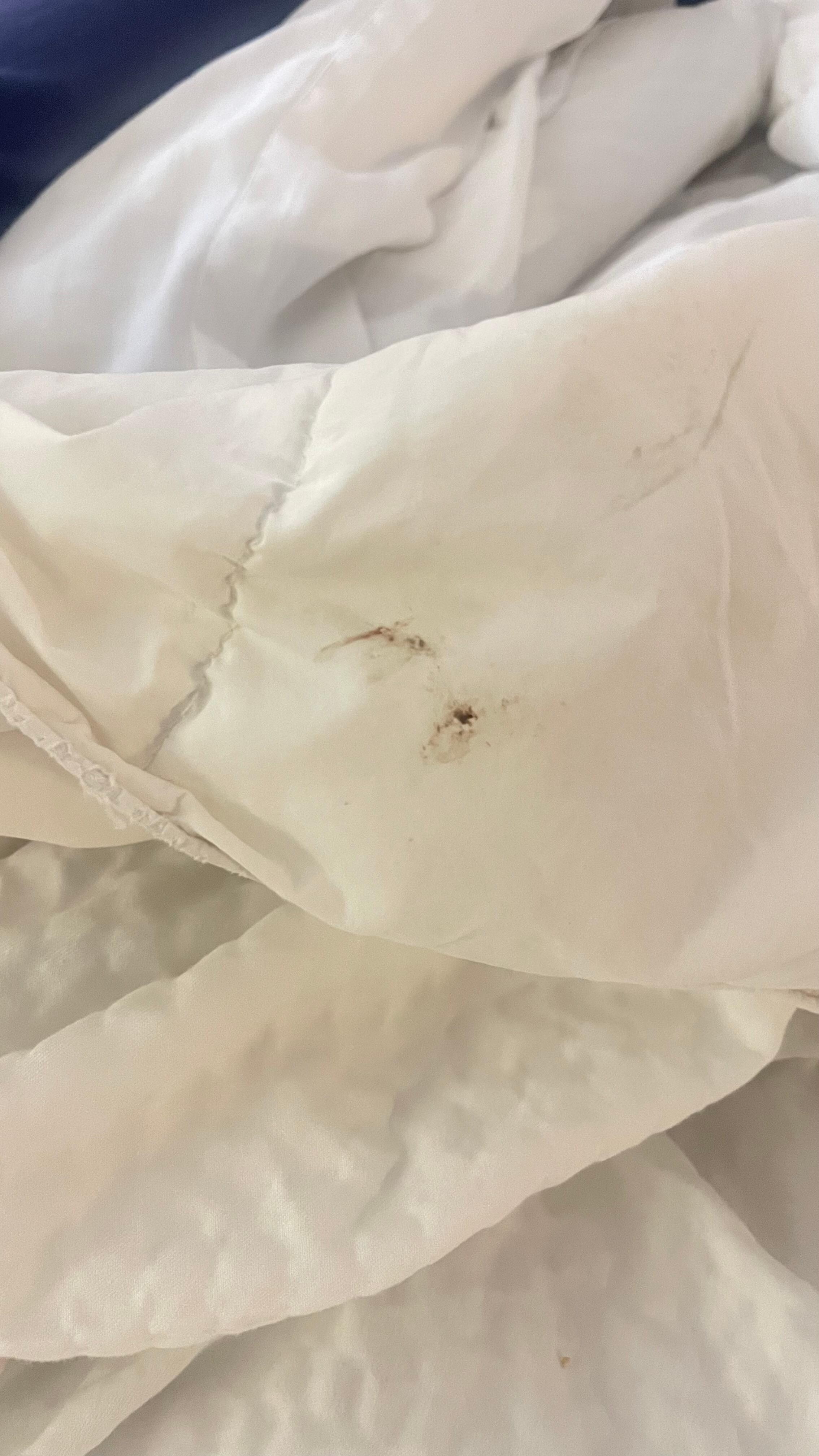 Uncleanliness
The bed linen 