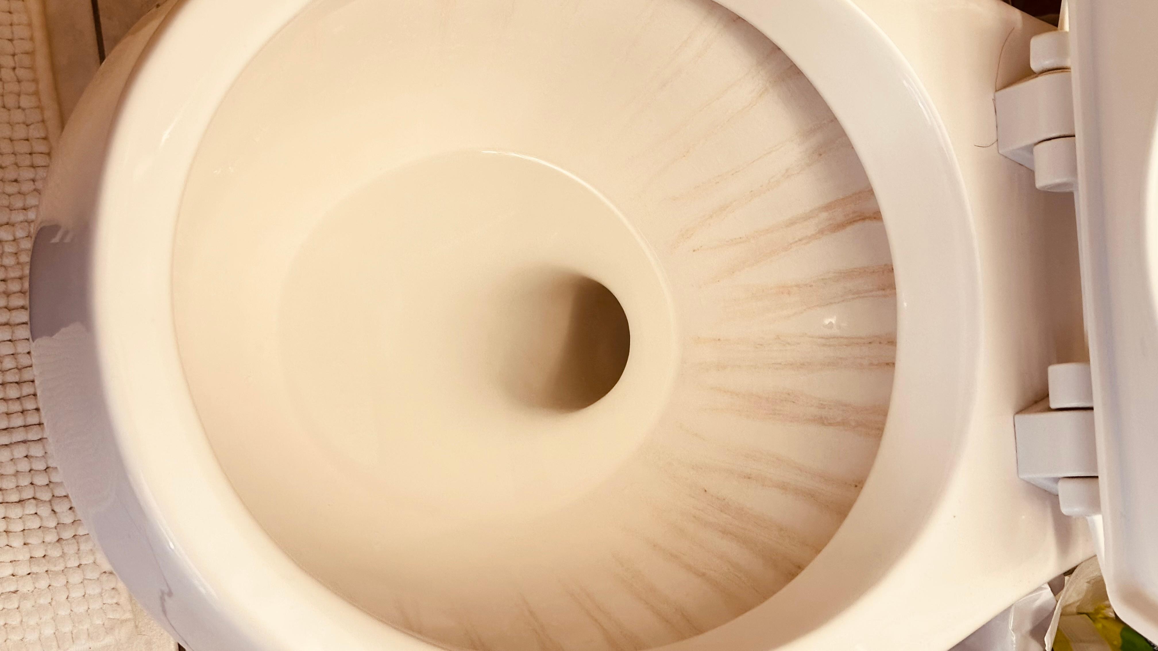 The photo sent is a demonstration of the unsanitary condition of the bathroom and room. 