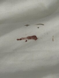 On the fitted sheet