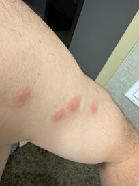 Don’t stay there they have bugs!!