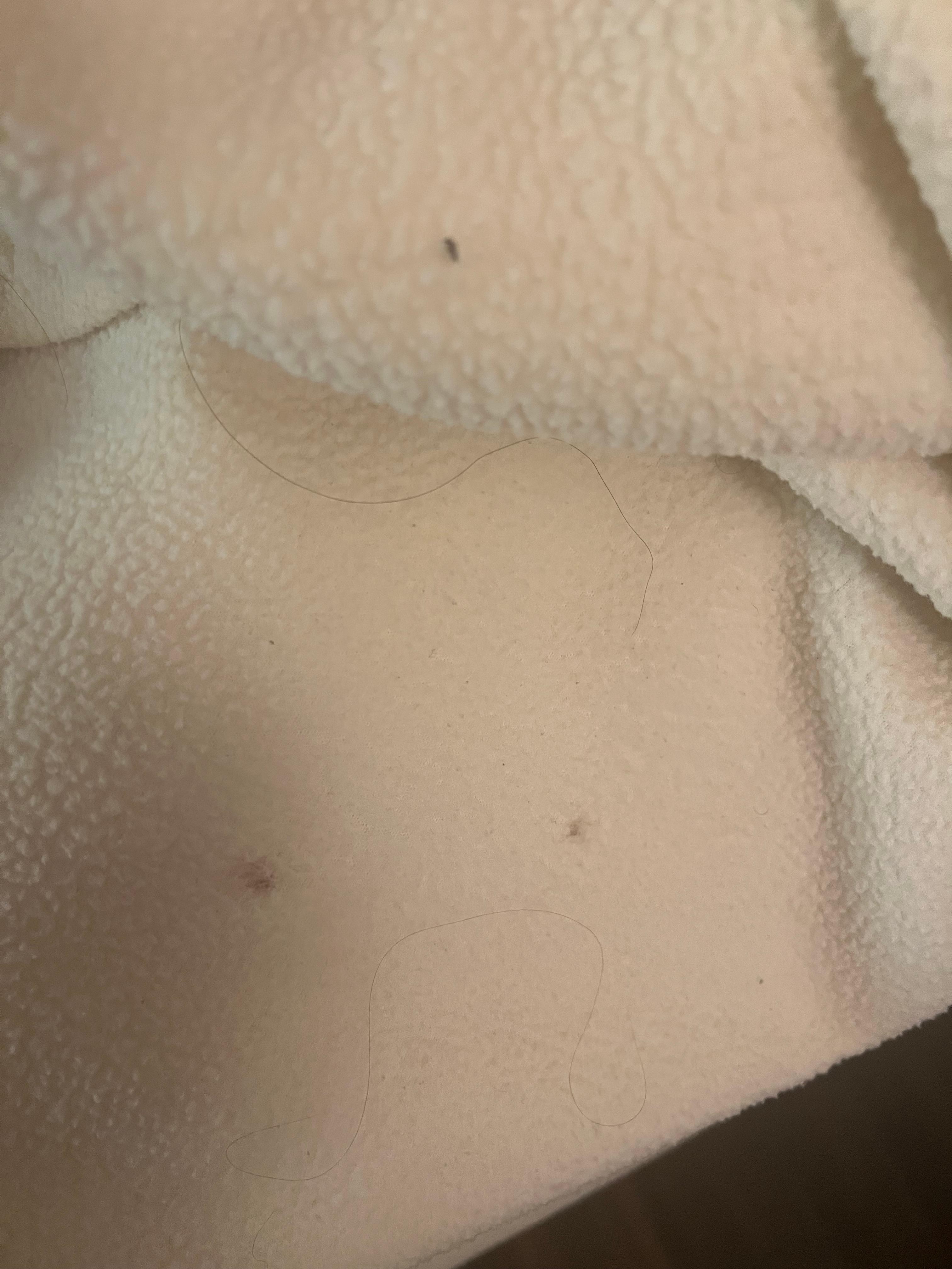 Small brown spot in numerous places