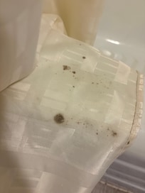 Moldy shower curtain