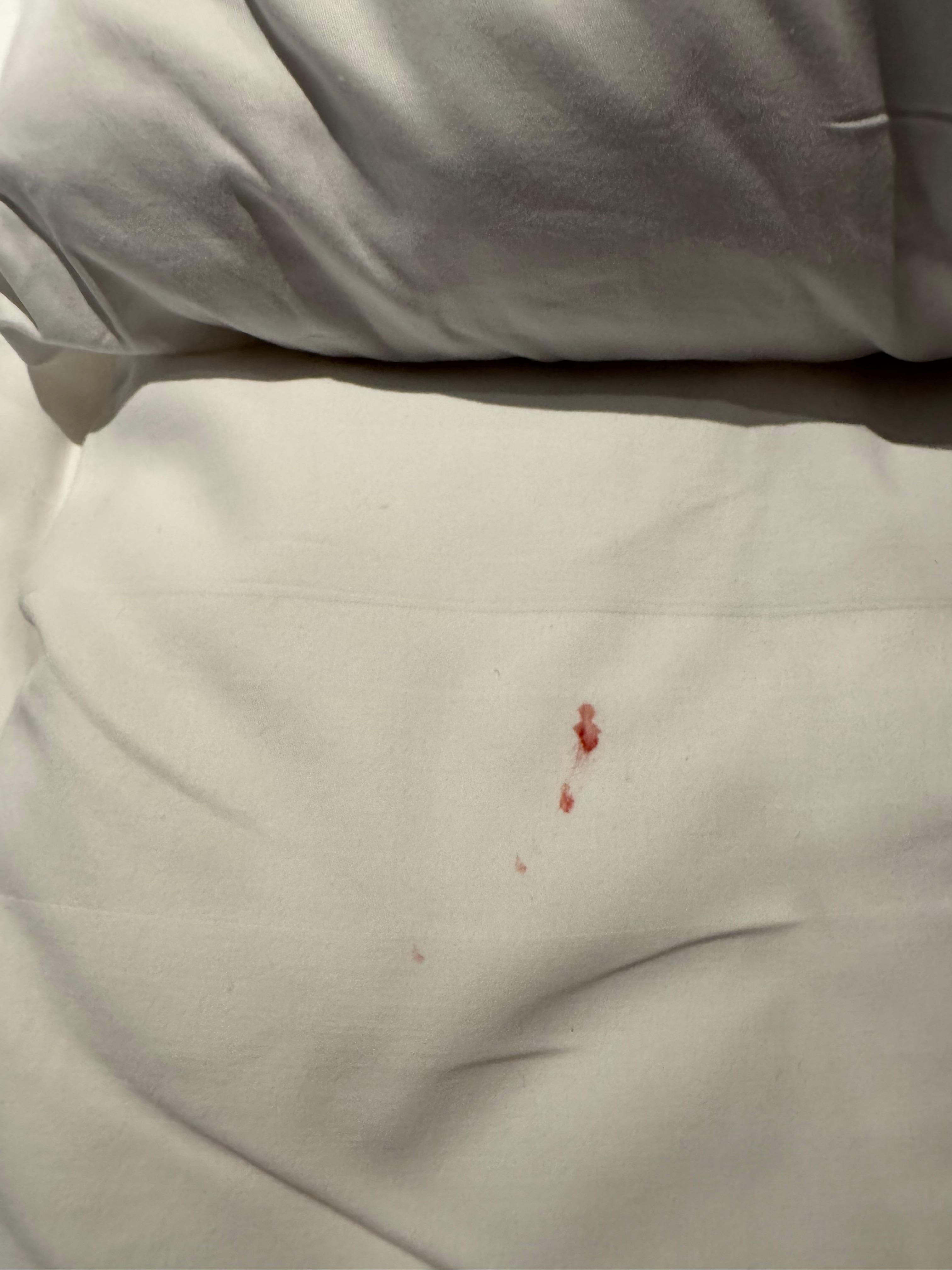 That blood was on the sheets as we walked in.