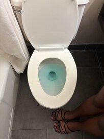 Dirty toilet seat