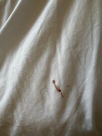Pillow blood stains