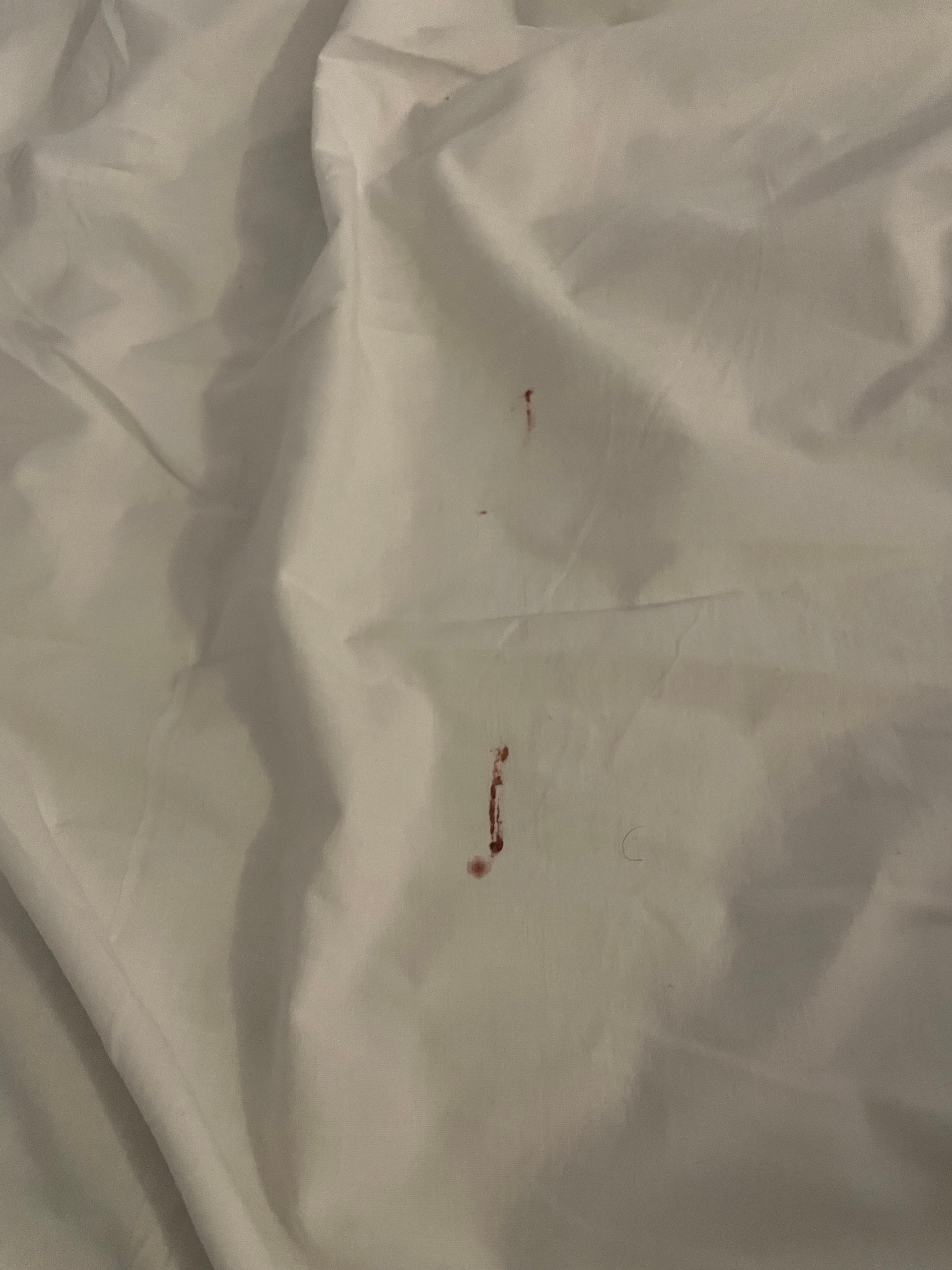 Woke up to bloody sheets from smacking mosquitos in the night