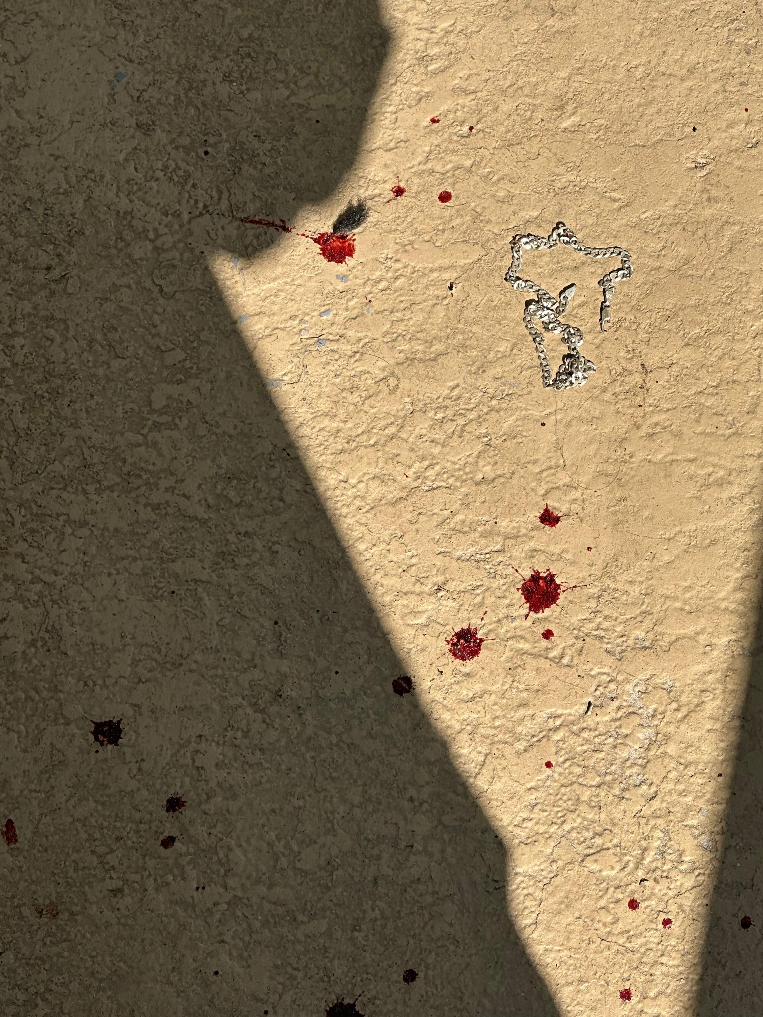 Blood from fighting at 2am 