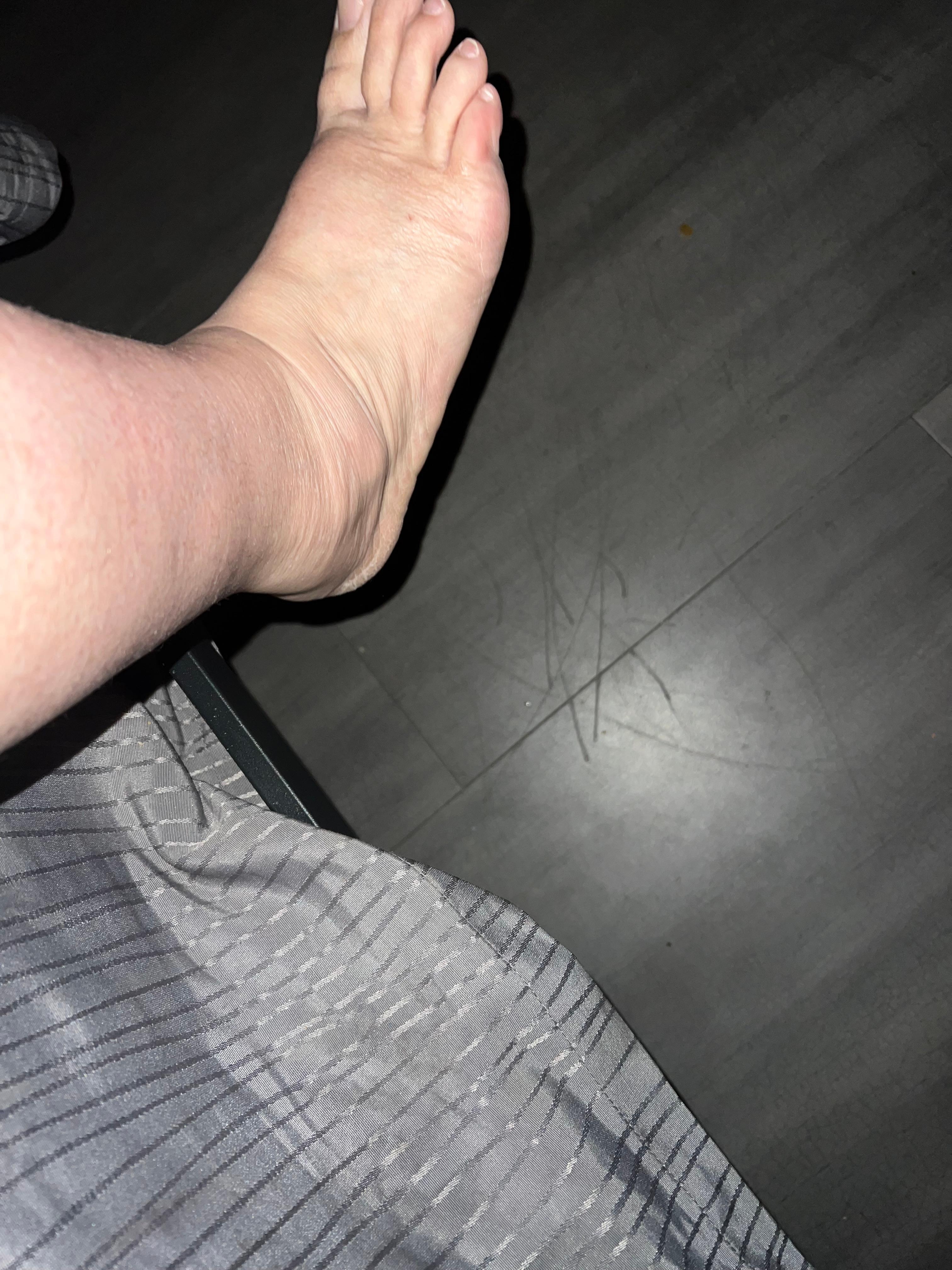 This is the other side that is leaning up in the air. I had to jump up in the bed and pull myself. My foot is a  foot off the ground seriously. 