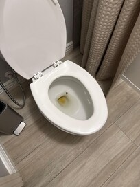 Feces in the dirty toilet