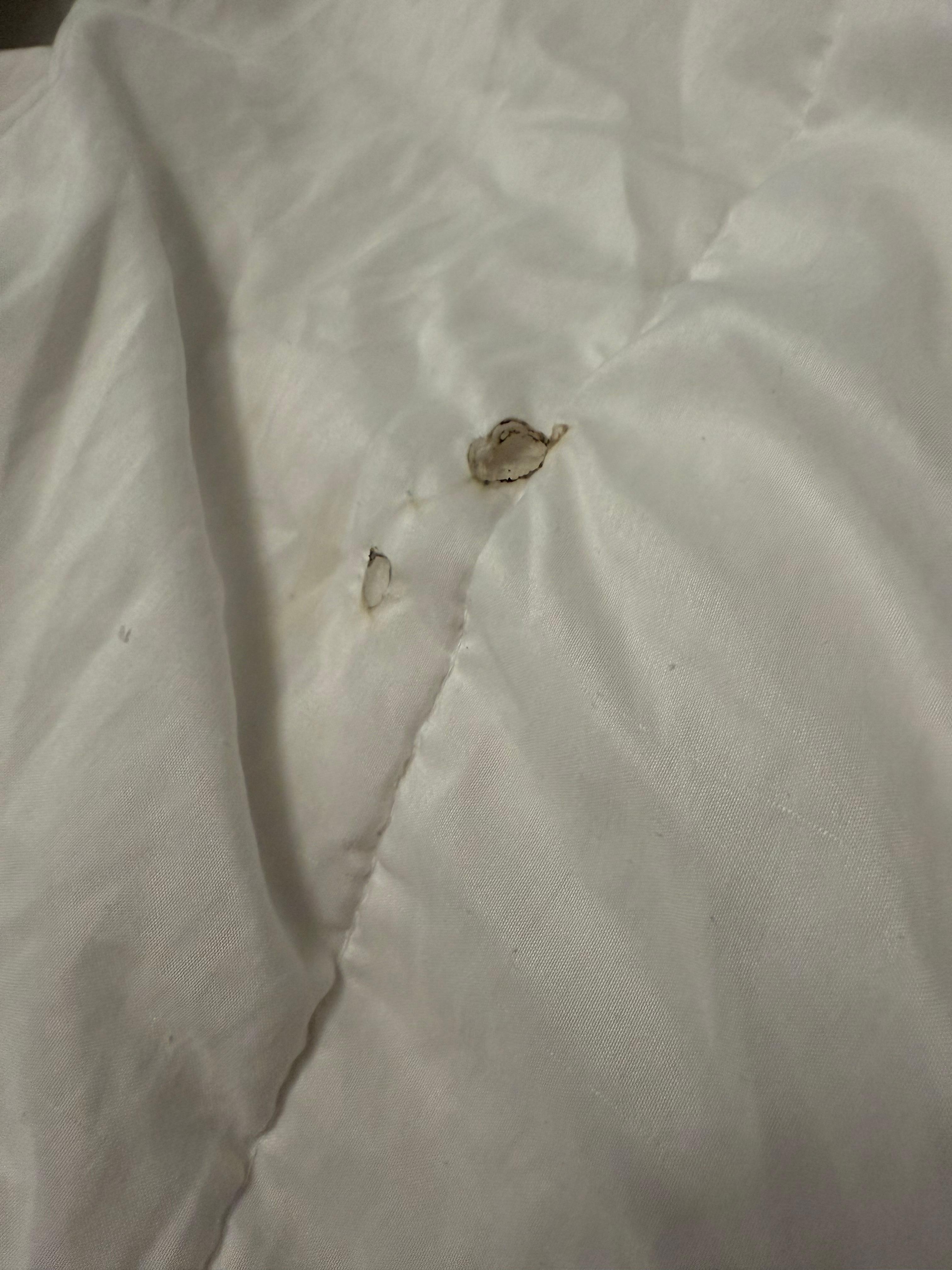 The cigarette hole on my bed sheet