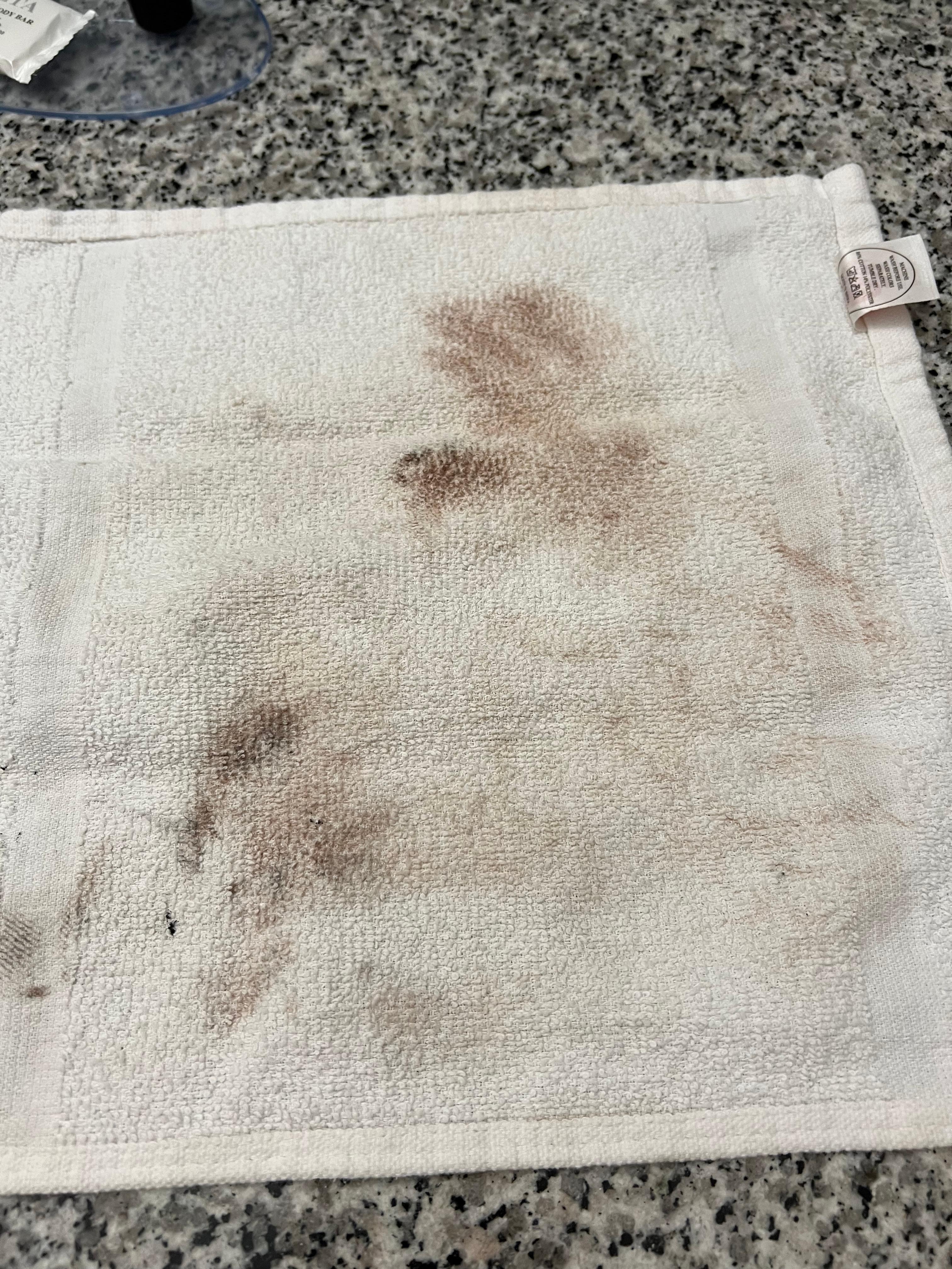 This was the washcloth hanging by the sink. 