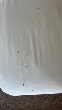 Blood, poop or chocolate on sheets not sure but either way very disgusting and disappointing