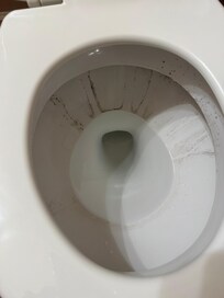 Dirty toulets
