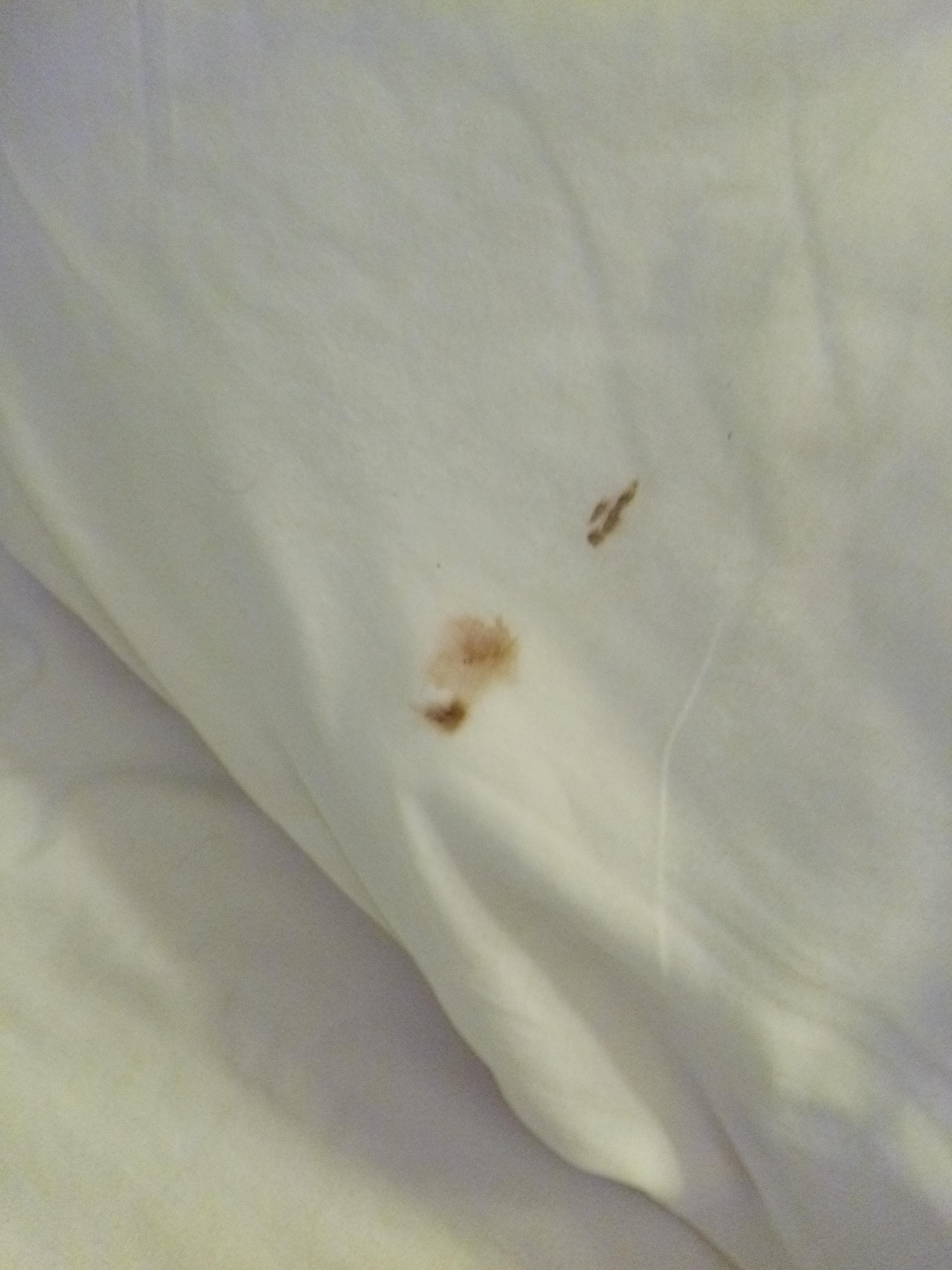That was a bug smeared on my pillow in the morning