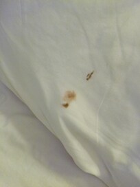 That was a bug smeared on my pillow in the morning