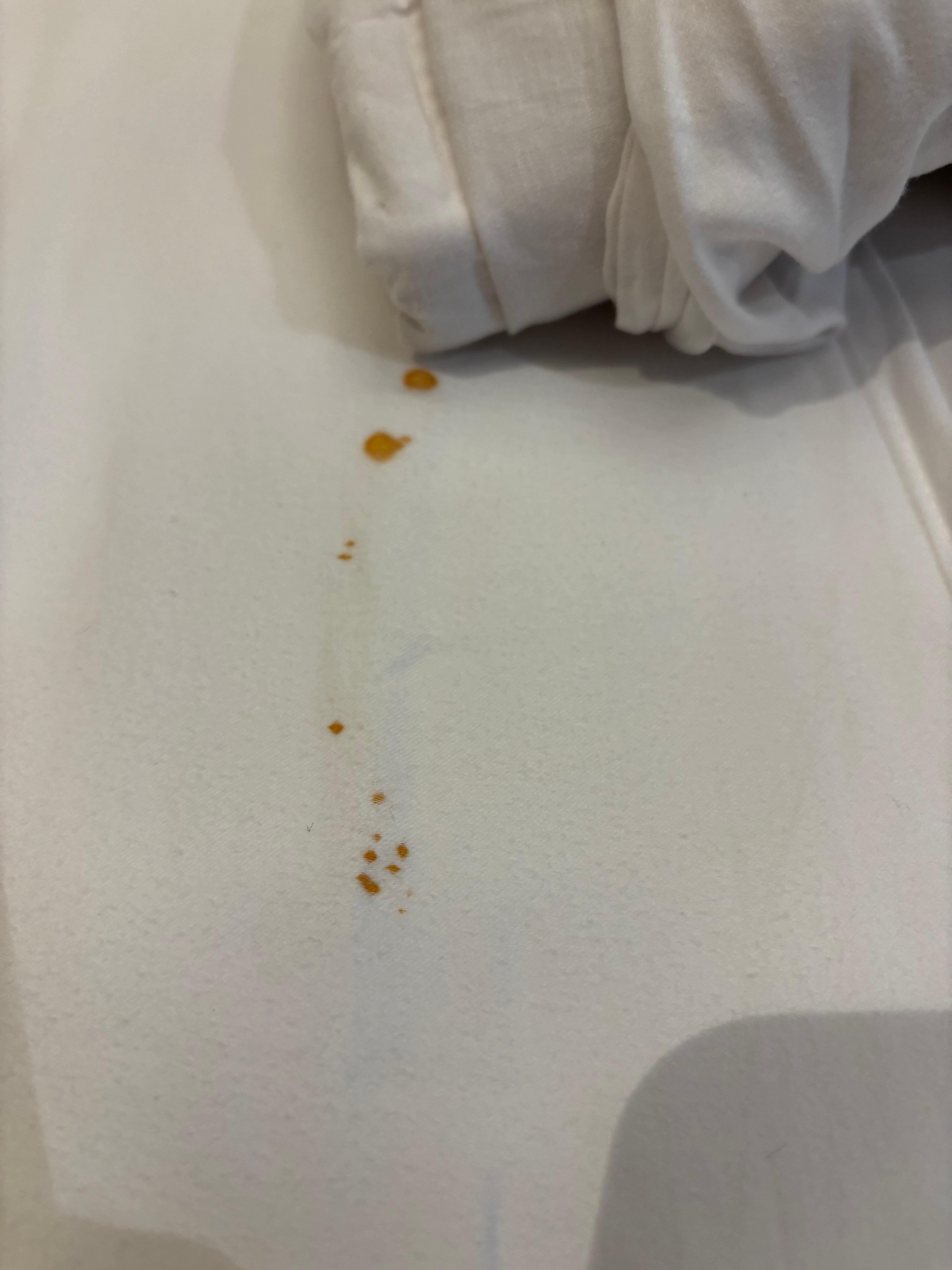 Blood on the sheets-not mine! 