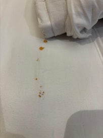 Blood on the sheets-not mine!