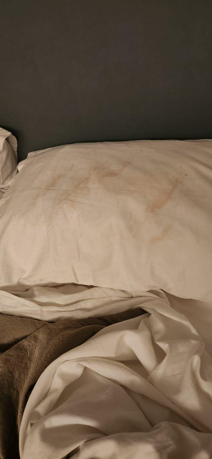 The housekeeper never changed the pillow case on Saturday night and the sheets. 