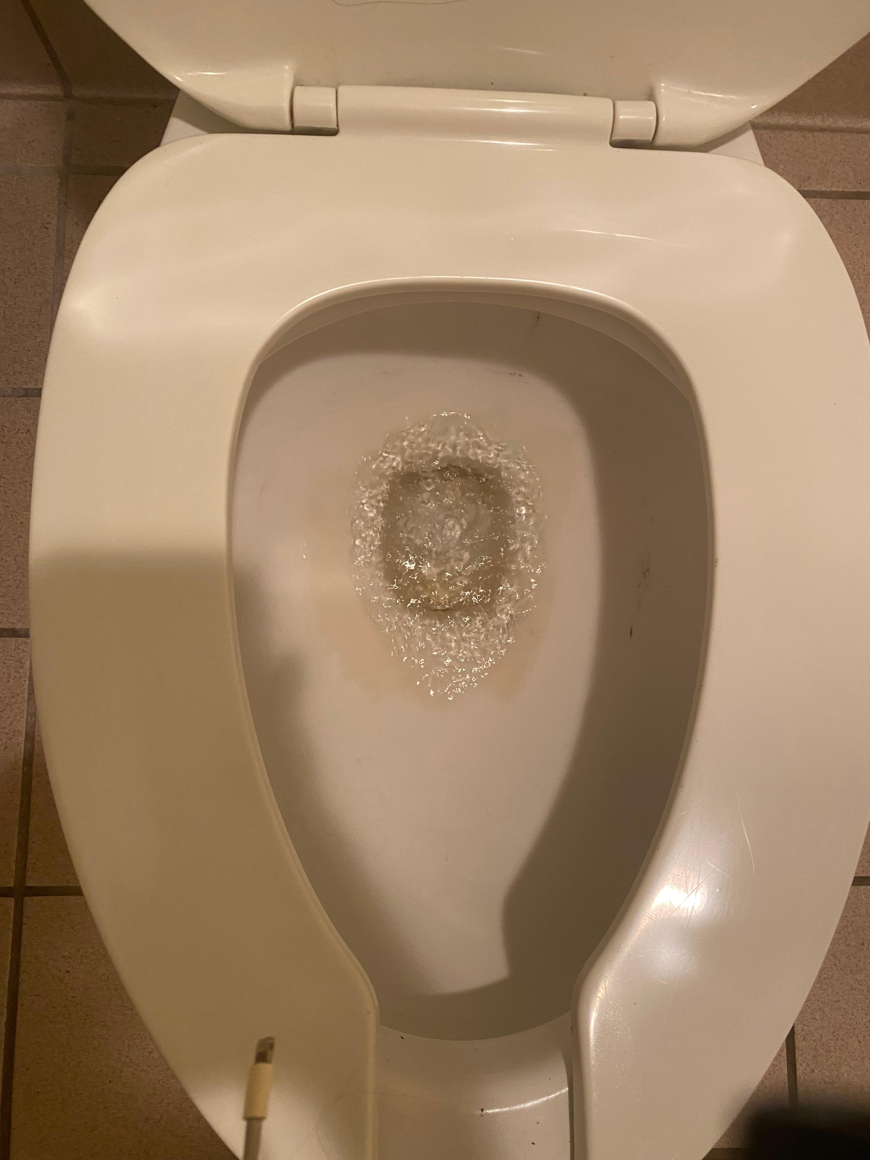 Toilet ring 
