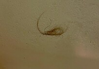 Someone’s hair that was around the bathroom drain that floated up once I started the shower.