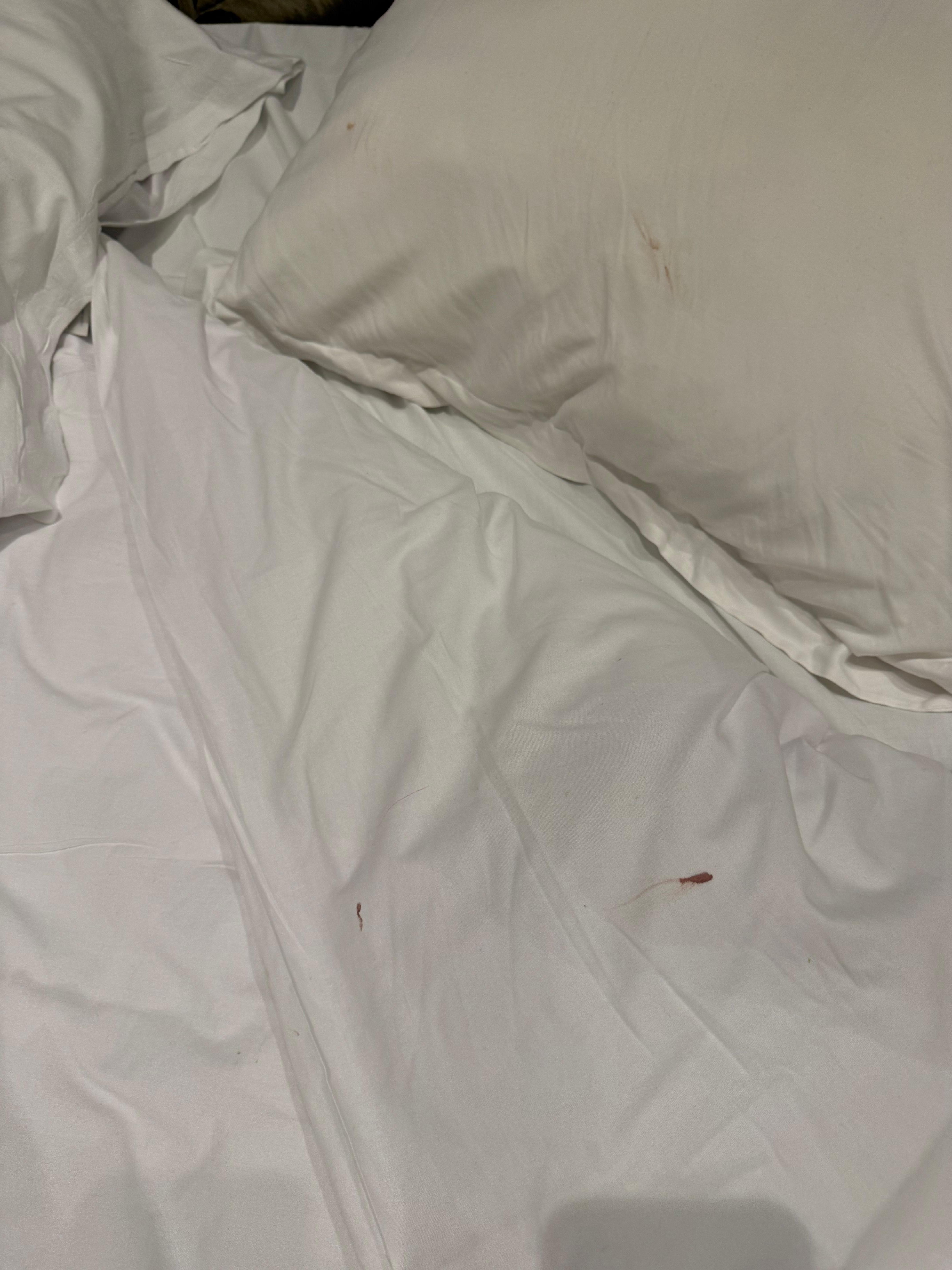 This is the blood on my bedsheets from the people before. 