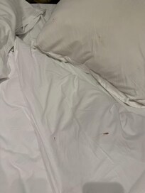 This is the blood on my bedsheets from the people before.