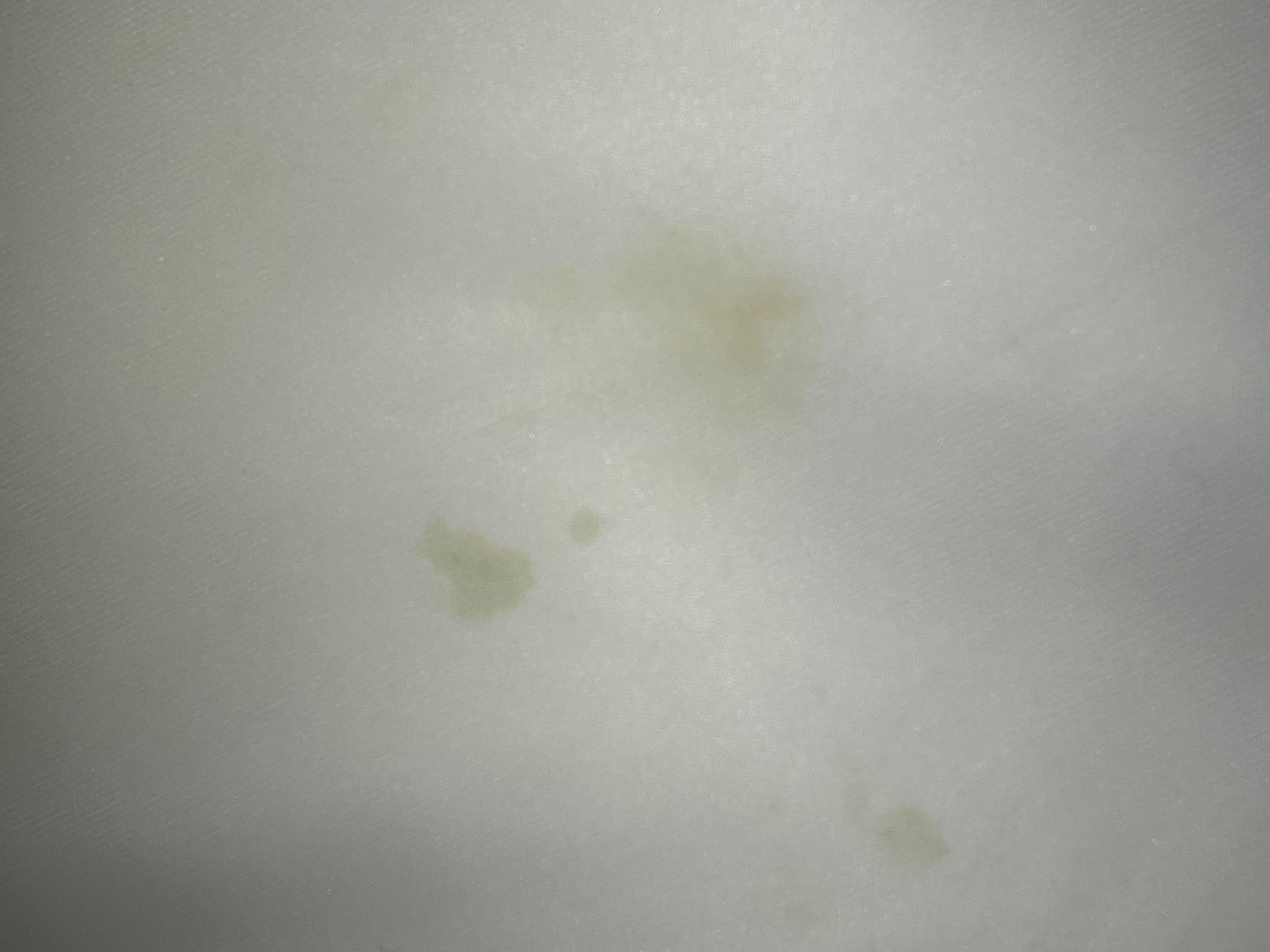 Stain on the top head area