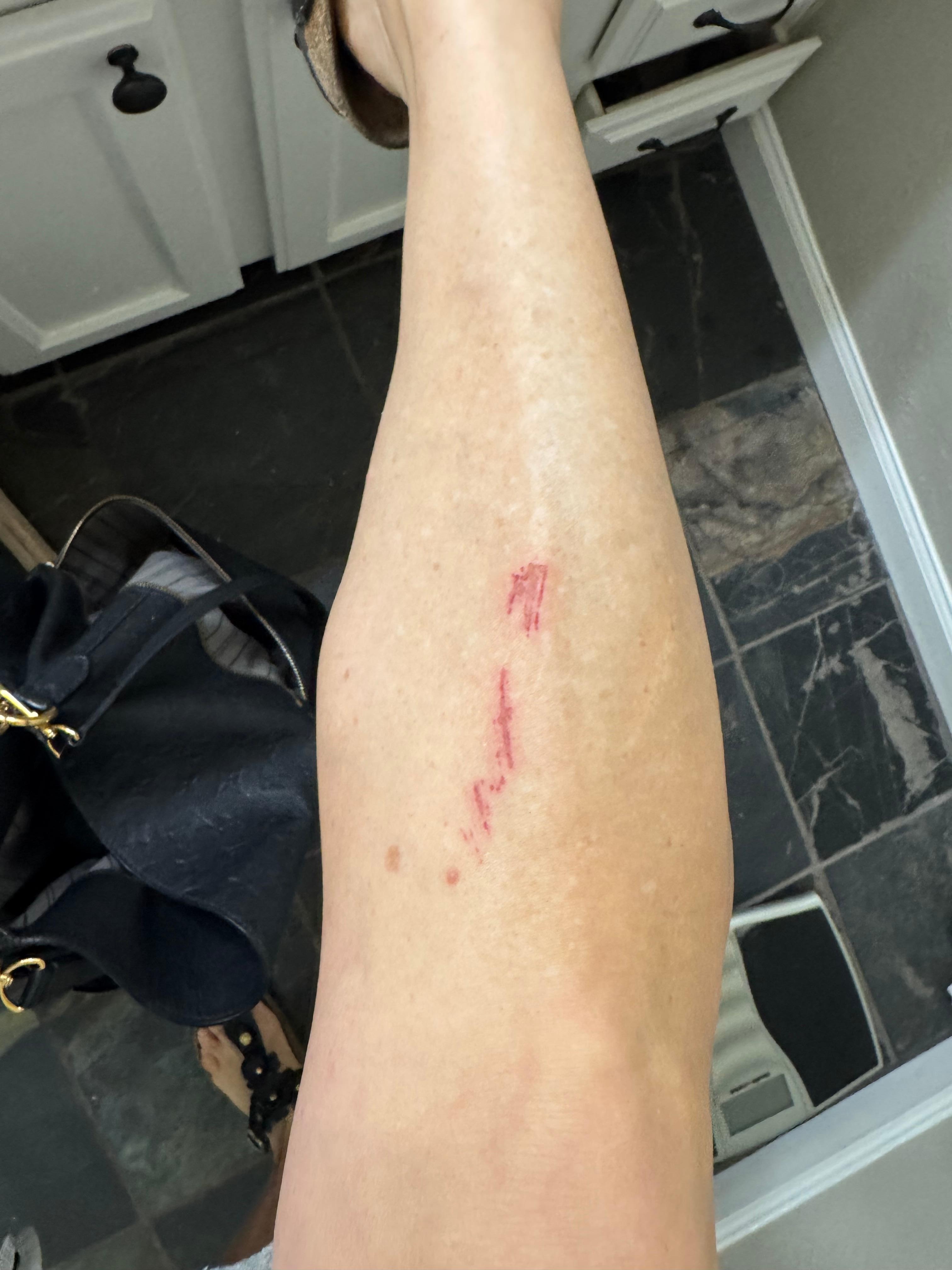 Scraped leg on jagged tiles in cool spa. 