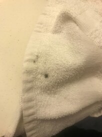 Cigarette burn in towel