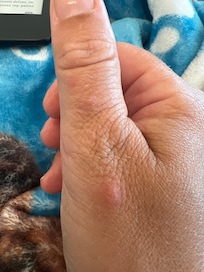 More bites