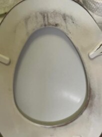 This was the toilet seat. Disgusting and just plain lazy by management.