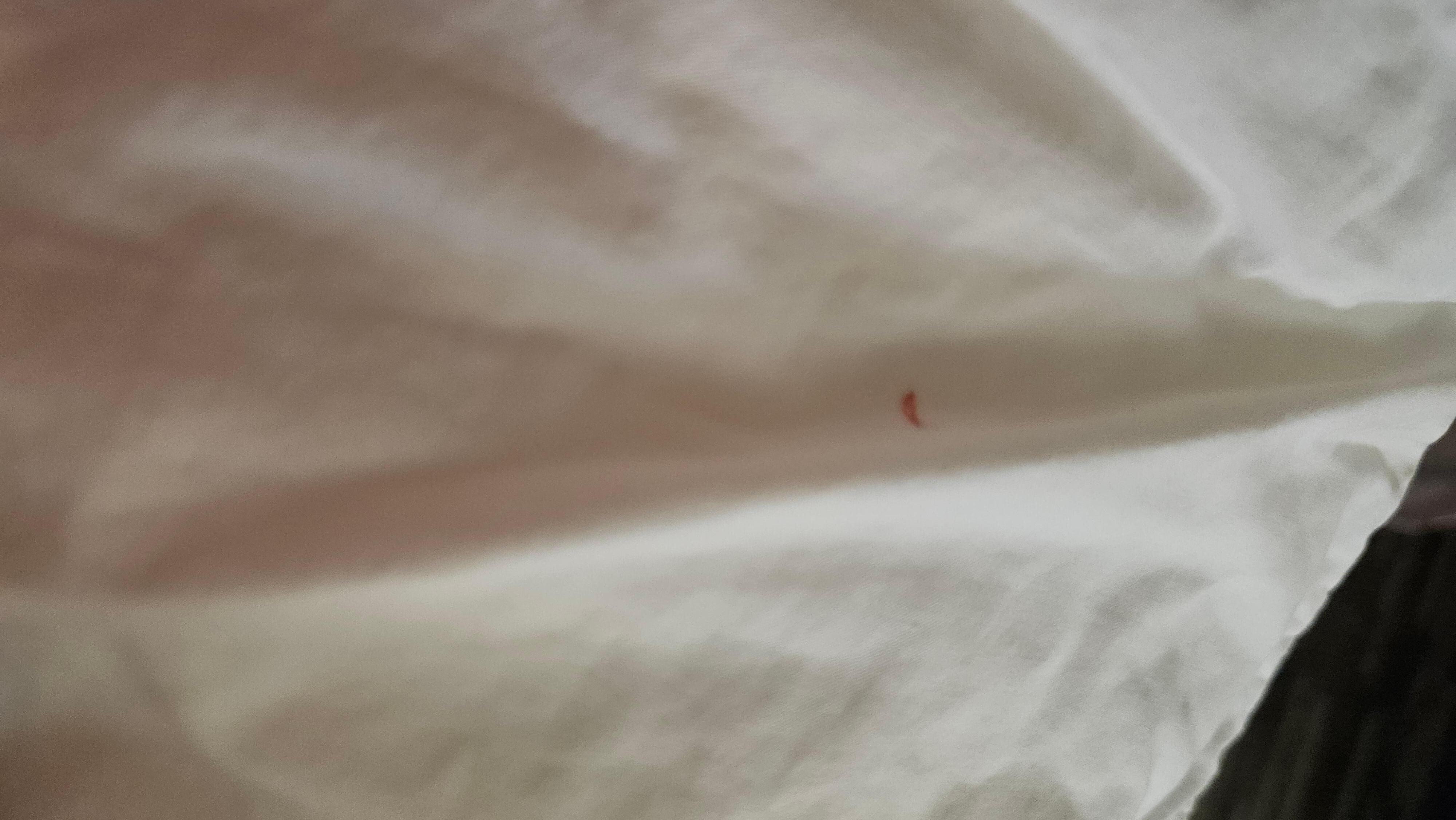 Dirt on sheets.