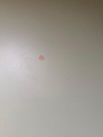 Damage on the wall when we got in