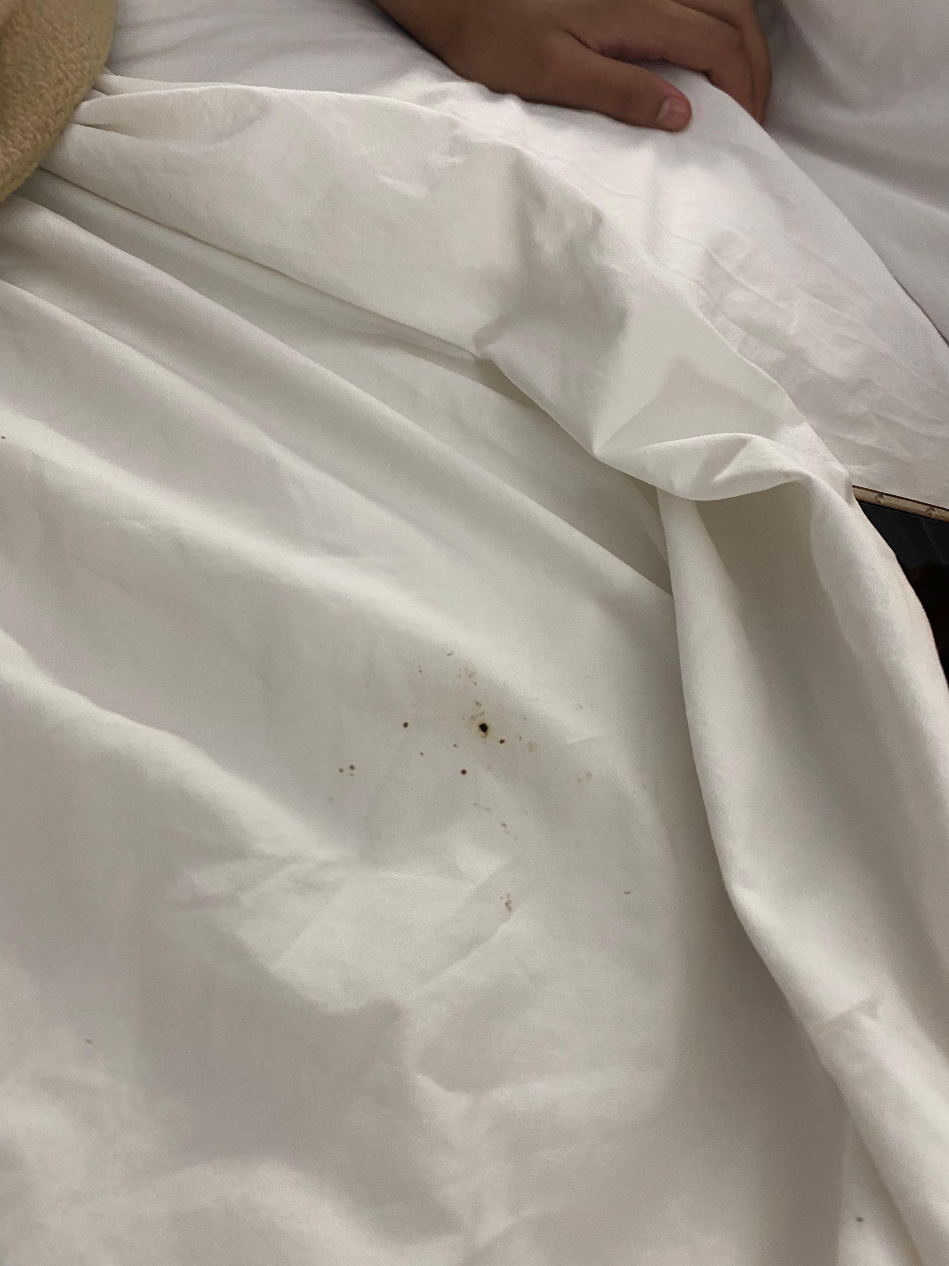 Sheets had stains and burn marks