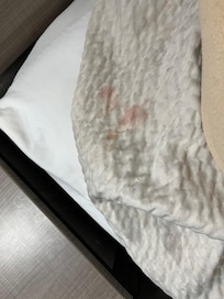 Comforter blood stains?