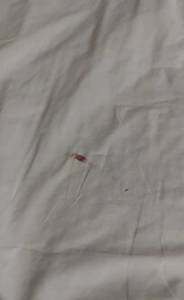 Blood stain