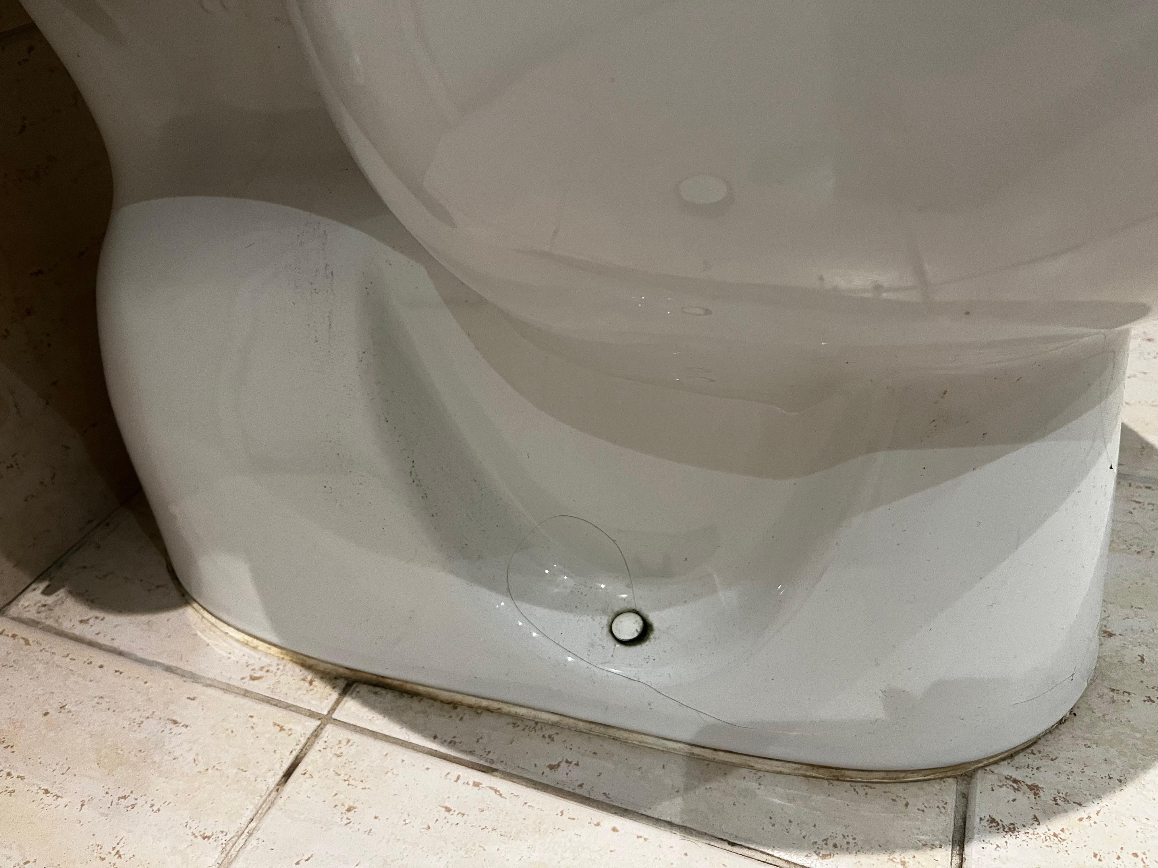 Hair and residue on toilet due to lack of cleaning. 