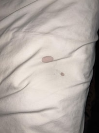 Stain that looks like blood