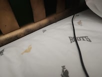 Hair on the bed.