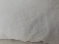 Hairs on sheets