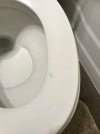 Feces on toilet seat