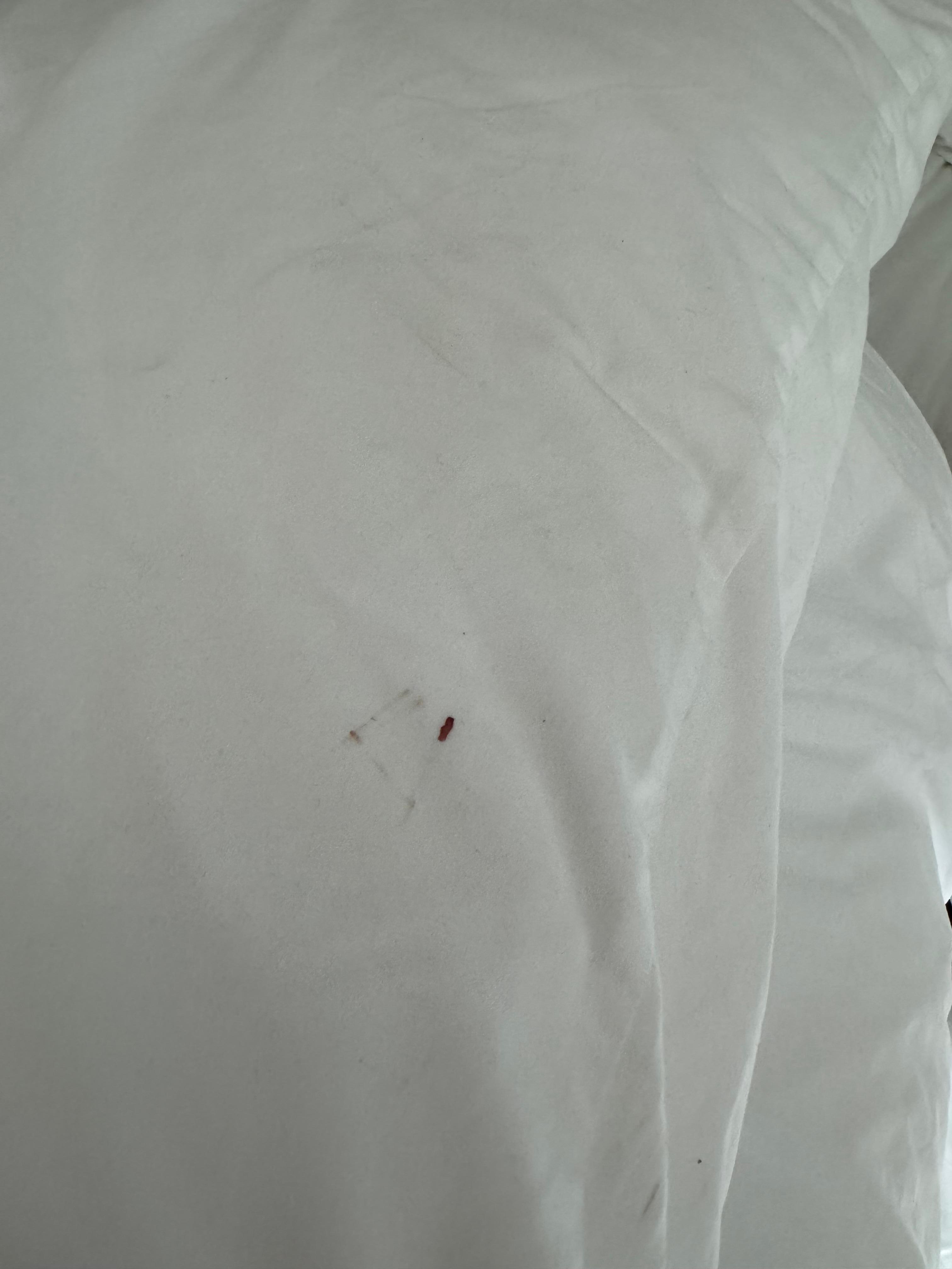 Blood on my pillowcase at check in