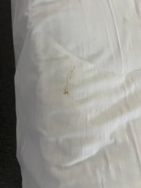 Poo stain on bedsheet