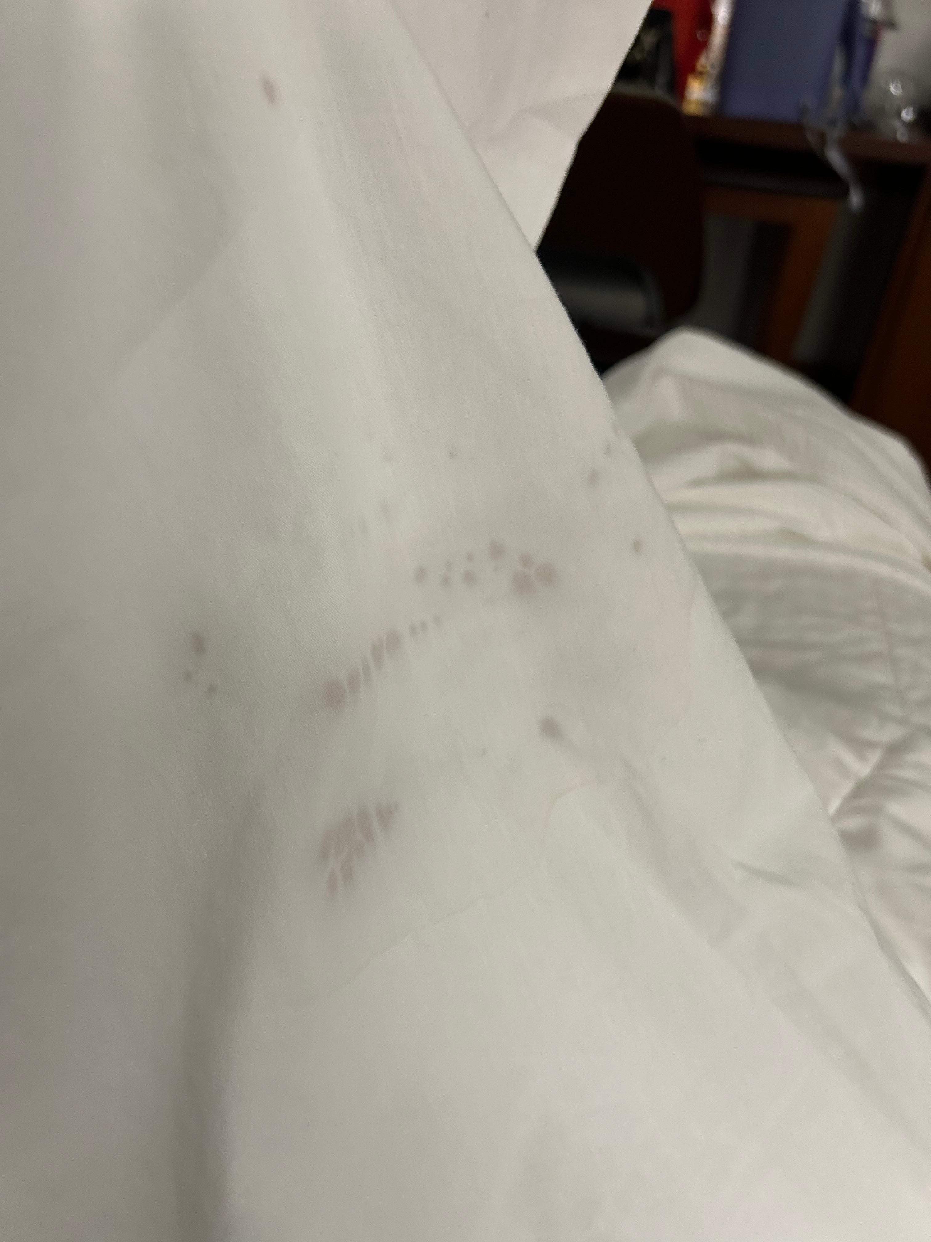 Stains on sheets