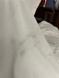 Stains on sheets