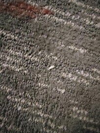 Toe nails. My wife had picked up several more.