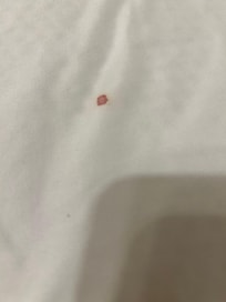 Blood stains on sheets.